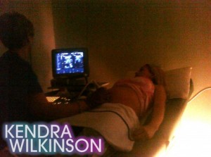 Kendra-Wilkinson-Hank-Baskett-Having-a-Baby-Boy-Ultrasound-0812091-430x321